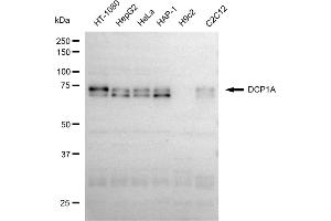 Western blotting analysis using DCP1A antibody (ABIN7798280).