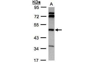 WB Image Sample(30 ug whole cell lysate) A:Hep G2 , 10% SDS PAGE antibody diluted at 1:1000 (BHMT anticorps)