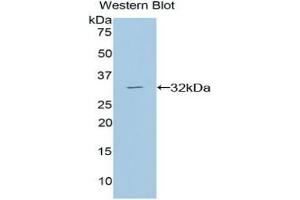 Detection of DGKa in Recombinant Diacylglycerol Kinase Alpha, Rat using Polyclonal Antibody to Diacylglycerol Kinase Alpha (DGKa) (DGKA anticorps  (AA 312-557))