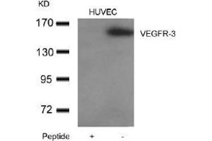 Western blot analysis of extracts from HUVEC cells using VEGFR-3and the same antibody preincubated with blocking peptide.
