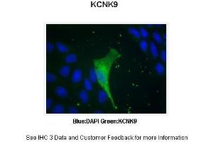 Immunohistochemistry (IHC) image for anti-Potassium Channel, Subfamily K, Member 9 (KCNK9) (N-Term) antibody (ABIN2776216) (KCNK9 anticorps  (N-Term))