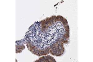 Immunohistochemical staining (Formalin-fixed paraffin-embedded sections) of human fallopian tube shows membranous and cytoplasmic positivity in glandular cells with CRKL polyclonal antibody . (CrkL anticorps  (AA 125-301))