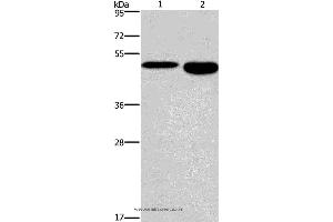 Western blot analysis of Mouse stomach and brain tissue, using DMRT3 Polyclonal Antibody at dilution of 1:550