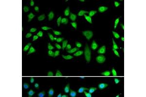 Immunofluorescence analysis of U2OS cells using DNAJB6 Polyclonal Antibody