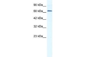 WB Suggested Anti-DDX21 Antibody Titration:  1. (DDX21 anticorps  (C-Term))