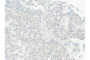 anti-TIP41-like protein (TIPRL) (C-Term) antibody