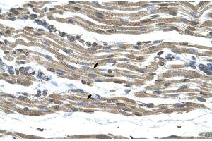 Rabbit Anti-COX15 Antibody  Paraffin Embedded Tissue: Human Muscle Cellular Data: Skeletal muscle cells Antibody Concentration: 4.