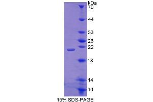 SDS-PAGE analysis of Mouse ACD Protein. (ACD Protéine)