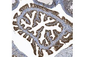 IHC analysis of FOXJ1 using anti-FOXJ1 antibody (ABIN7601015). (FOXJ1 anticorps  (AA 27-405))