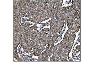 IHC analysis of LRP1B using anti-LRP1B antibody (ABIN7601521). (LRP1B anticorps  (AA 3704-4547))