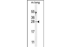 Western blot analysis in mouse lung tissue lysates (35ug/lane). (OAZ2 anticorps  (C-Term))