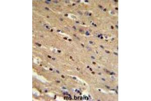 Immunohistochemistry (IHC) image for anti-Tumor Protein P73 (TP73) antibody (ABIN3003949)