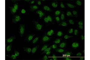 Immunofluorescence of monoclonal antibody to FOXR2 on HeLa cell. (FOXR2 anticorps  (AA 1-311))