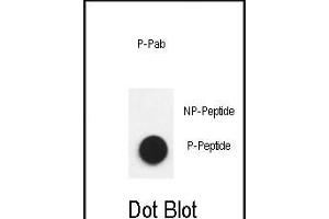 Dot blot analysis of anti-Phospho-Nephrin  antibody Phospho-specific Pab (ABIN650883 and ABIN2839826) on nitrocellulose membrane.