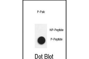 Dot blot analysis of anti-Phospho-Nephrin  antibody Phospho-specific Pab (ABIN650883 and ABIN2839826) on nitrocellulose membrane. (Nephrin anticorps  (pTyr1193))