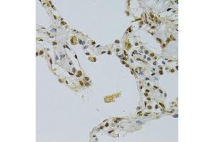 Immunohistochemistry of paraffin-embedded human lung using NLK antibody (ABIN5971636) at dilution of 1/100 (40x lens). (Nemo-Like Kinase anticorps)