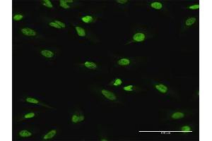 Immunofluorescence of purified MaxPab antibody to ATF1 on HeLa cell.