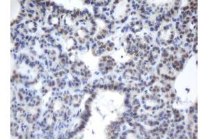 Image no. 1 for anti-Chromobox Homolog 8 (CBX8) (AA 1-260) antibody (ABIN1490660)
