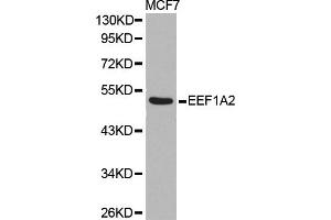 Western blot analysis of extracts of MCF7 cell line, using EEF1A2 antibody.