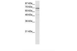 Image no. 1 for anti-Zinc Finger Protein 614 (ZNF614) (AA 56-105) antibody (ABIN6736025) (ZNF614 anticorps  (AA 56-105))