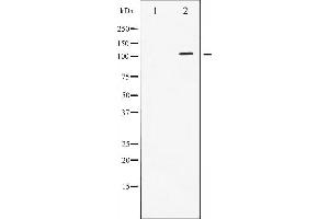 Western blot analysis of STAT2 phosphorylation expression in IFN treated HeLa whole cell lysates,The lane on the left is treated with the antigen-specific peptide. (STAT2 anticorps  (pTyr690))