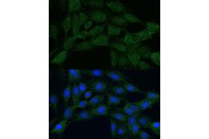 Immunofluorescence analysis of C6 cells using MTHFD2 antibody (ABIN6132367, ABIN6144144, ABIN6144145 and ABIN6214625) at dilution of 1:100.