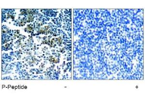 Image no. 1 for anti-Breakpoint Cluster Region (BCR) (pTyr177) antibody (ABIN196938) (BCR anticorps  (pTyr177))