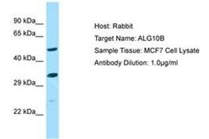 Image no. 1 for anti-Asparagine-Linked Glycosylation 10, alpha-1,2-Glucosyltransferase Homolog B (ALG10B) (AA 179-228) antibody (ABIN6750149) (ALG10B anticorps  (AA 179-228))