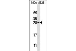 Western blot analysis in MDA-MB231 cell line lysates (35ug/lane). (Kallikrein 7 anticorps  (AA 67-97))
