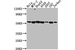 Western Blot Positive WB detected in: Hela whole cell lysate, MCF-7 whole cell lysate, HepG2 whole cell lysate, A549 whole cell lysate, 293T whole cell lysate, U87 whole cell lysate, Jurkat whole cell lysate All lanes: PRAMEF6 antibody at 1:2000 Secondary Goat polyclonal to rabbit IgG at 1/50000 dilution Predicted band size: 55 kDa Observed band size: 55 kDa (PRAMEF6 anticorps  (AA 209-476))