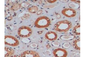 Detection of MGMT in Human Kidney Tissue using Polyclonal Antibody to O-6-Methylguanine DNA Methyltransferase (MGMT)