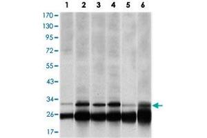 Western blot analysis using PSMB8 monoclonal antobody, clone 1A5  against HeLa (1), MCF-7 (2), A-431 (3), RAJI (4), MOTL4 (5) and PC-12 (6) cell lysate.