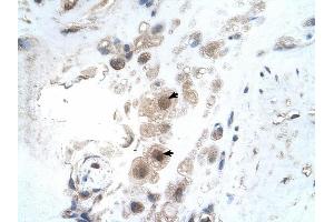 KIAA0494 antibody was used for immunohistochemistry at a concentration of 4-8 ug/ml to stain Decidual cells (arrows) in Human Placenta.
