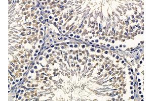 ABIN6262812 and ABIN6278290 at 1/100 staining rat testis tissue by IHC-P.