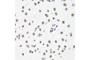 anti-Histone Cluster 1, H2bg (HIST1H2BG) antibody