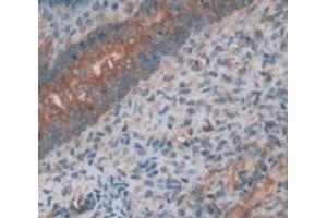 IHC-P analysis of Kidney tissue, with DAB staining. (PLAP anticorps  (AA 68-313))
