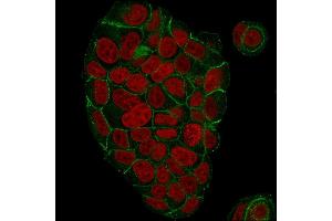 Immunofluorescent staining of paraformaldehyde-fixed MCF-7 cells with Catenin, gamma Mouse Monoclonal Antibody (CTNG/1664) followed by goat anti-Mouse IgG-CF488 (Green).