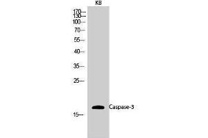 Western Blotting (WB) image for anti-Caspase 3 (CASP3) (Ser1981) antibody (ABIN3179903) (Caspase 3 anticorps  (Ser1981))