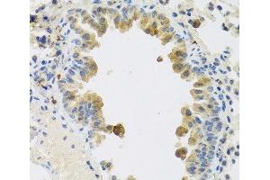 Immunohistochemistry of paraffin-embedded Mouse lung using RSPO1 Polyclonal Antibody at dilution of 1:100 (40x lens). (RSPO1 anticorps)