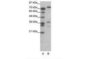 Image no. 1 for anti-CAMP Responsive Element Binding Protein 3 (CREB3) (AA 247-296) antibody (ABIN6736064) (CREB3 anticorps  (AA 247-296))