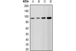 Western blot analysis of Lsh expression in A549 (A), HepG2 (B), mouse spleen (C), rat testis (D) whole cell lysates. (SLC11A1 anticorps)