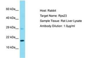 Image no. 1 for anti-Ribosomal Protein S23 (RPS23) (AA 15-64) antibody (ABIN6750515) (RPS23 anticorps  (AA 15-64))