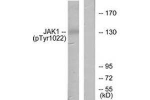 Western blot analysis of extracts from A549 cells , using JAK1 (Phospho-Tyr1022) Antibody. (JAK1 anticorps  (pTyr1022))