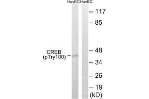 Western Blotting (WB) image for anti-cAMP Responsive Element Binding Protein 1 (CREB1) (pThr100) antibody (ABIN1847546) (CREB1 anticorps  (pThr100))