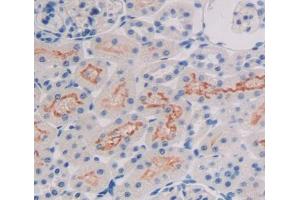Used in DAB staining on fromalin fixed paraffin- embedded Kidney tissue (ALOX15B anticorps  (AA 349-633))