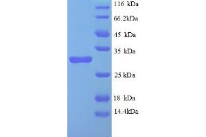 SDS-PAGE (SDS) image for Egl-9 Family Hypoxia Inducible Factor 3 (EGLN3) (AA 2-239) protein (His tag) (ABIN5712938)