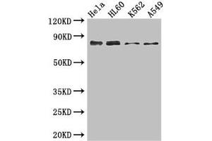 Western Blot Positive WB detected in: Hela whole cell lysate, HL60 whole cell lysate, K562 whole cell lysate, A549 whole cell lysate All lanes: SSRP1 antibody at 3. (SSRP1 anticorps  (AA 1-242))