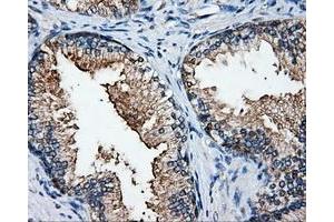 Immunohistochemical staining of paraffin-embedded Kidney tissue using anti-ELAVL1mouse monoclonal antibody. (ELAVL1 anticorps)