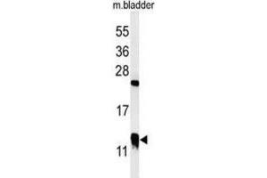 Western Blotting (WB) image for anti-Cysteine-Rich Protein 1 (Intestinal) (CRIP1) antibody (ABIN3002116)