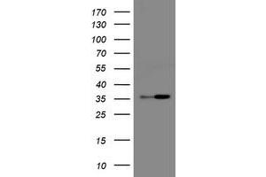 Image no. 1 for anti-Replication Factor C (Activator 1) 2, 40kDa (RFC2) antibody (ABIN1500671) (RFC2 anticorps)
